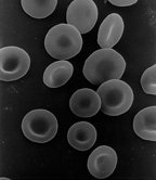 Healthy, normal red blood cells