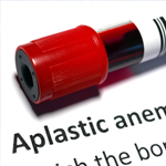 a vial containing blood sits above the words Aplastic anemia
