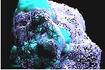 Fusion Imaging - 3D colorized-fusion imaging defines tumors as targets for thermal ablation