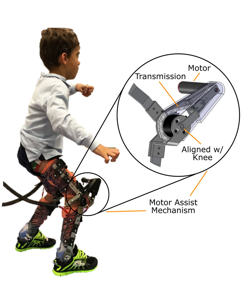 A participant walking with the powered exoskeleton for treatment of crouch gait